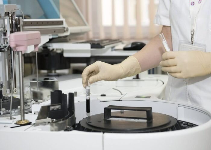 What Is Included in a Full STD Test in Singapore?