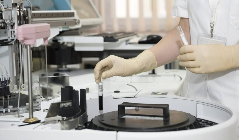 What Is Included in a Full STD Test in Singapore?
