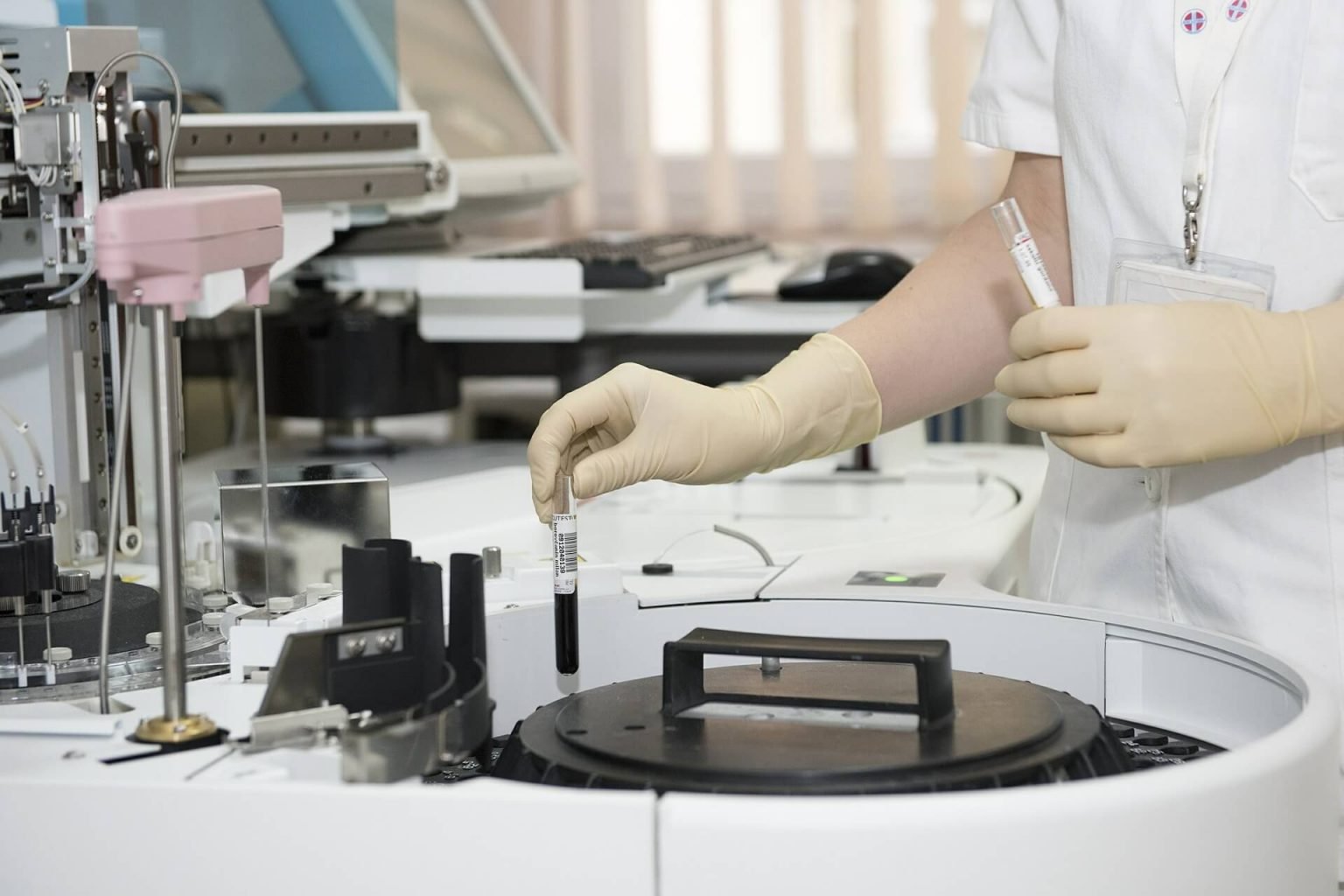 What Is Included in a Full STD Test in Singapore?